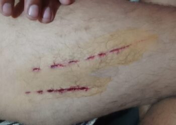 बाइक सवार लोगों पर गुलदार का हमला,दो घायल