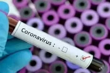 बीते 24 घंटे के भीतर प्रदेश में 147 लोग मिले कोरोना संक्रमित, एक मरीज की मौत