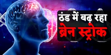 ठंड में बढ़ जाता है ब्रेन स्ट्रोक का खतरा। ऐसे पहचानें लक्षण, ऐसे रखें सावधानी