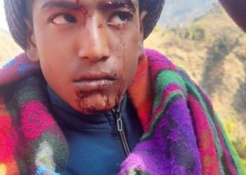 स्कूल पेपर देने जा रहे छात्र पर गुलदार का हमला