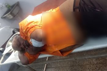 पत्नी के साथ देवप्रयाग जा रहे व्यक्ति पर गुलदार ने मारा झपट्टा, बुरी तरह हुआ जख्मी