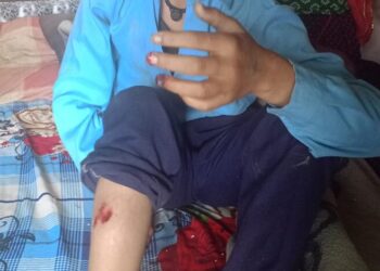 स्कूल जाते बालक पर गुलदार ने किया हमला