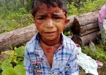 7 वर्षीय बालक पर गुलदार ने किया जानलेवा हमला, क्षेत्र में दहशत