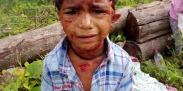 7 वर्षीय बालक पर गुलदार ने किया जानलेवा हमला, क्षेत्र में दहशत